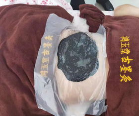 九江純中藥泥灸生產全國發貨 多圖